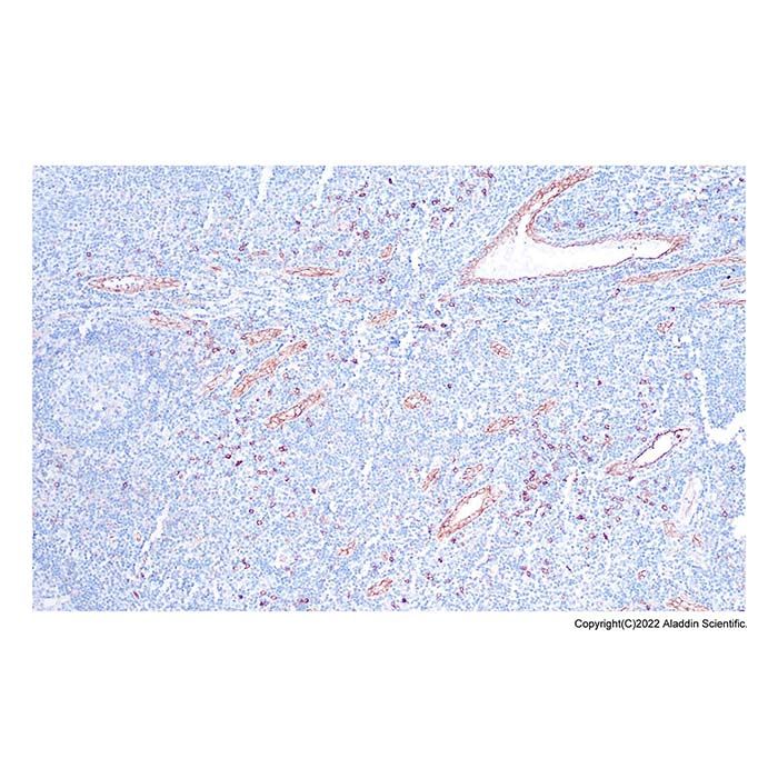 Recombinant IL3RA/CD123 Antibody