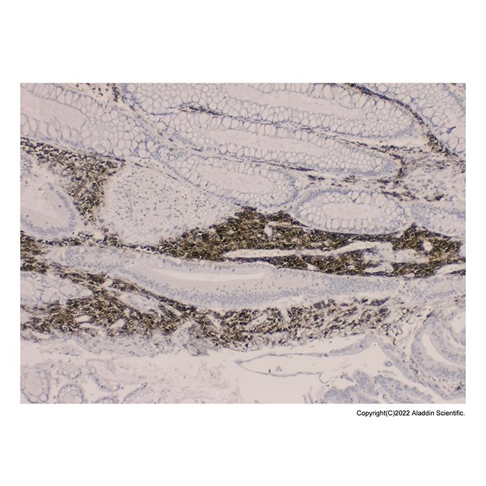 Recombinant CD38 Antibody