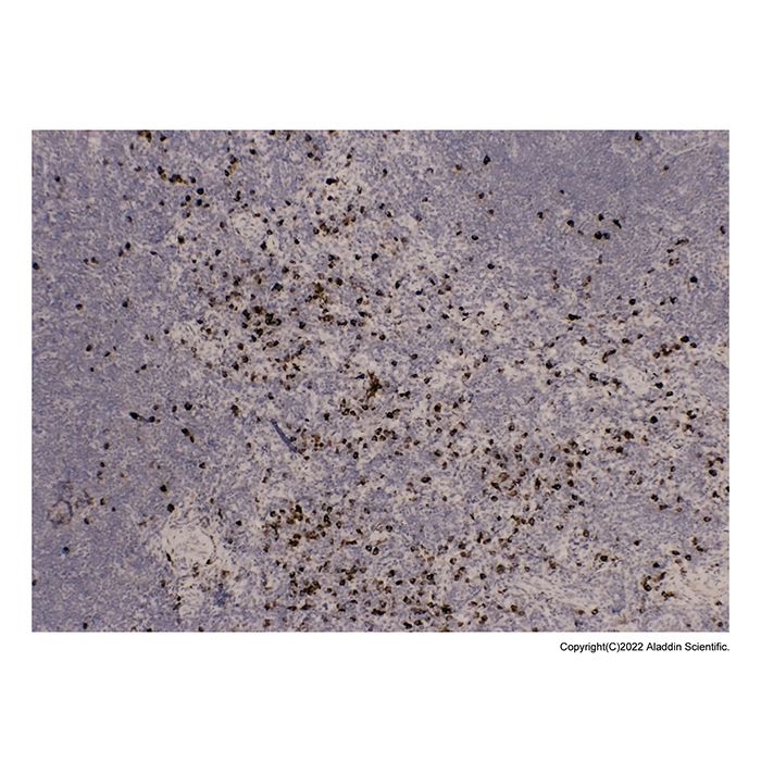 IgA Antibody