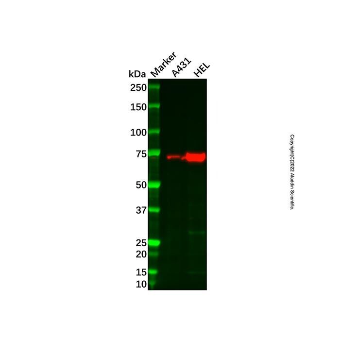 Recombinant 12 Lipoxygenase/ALOX12 Antibody