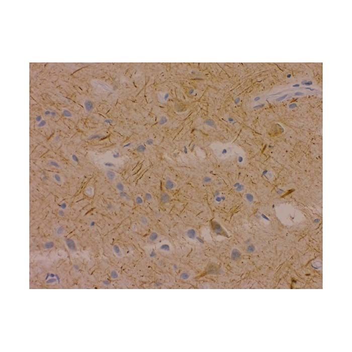 Recombinant Neurofilament-M Antibody