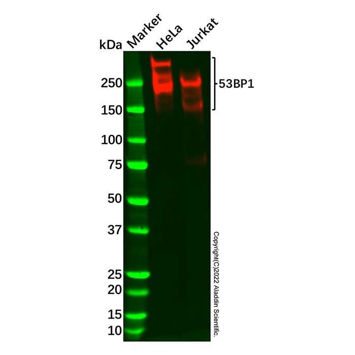 53BP1 Antibody