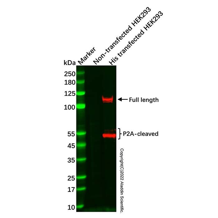 Recombinant His tag Antibody