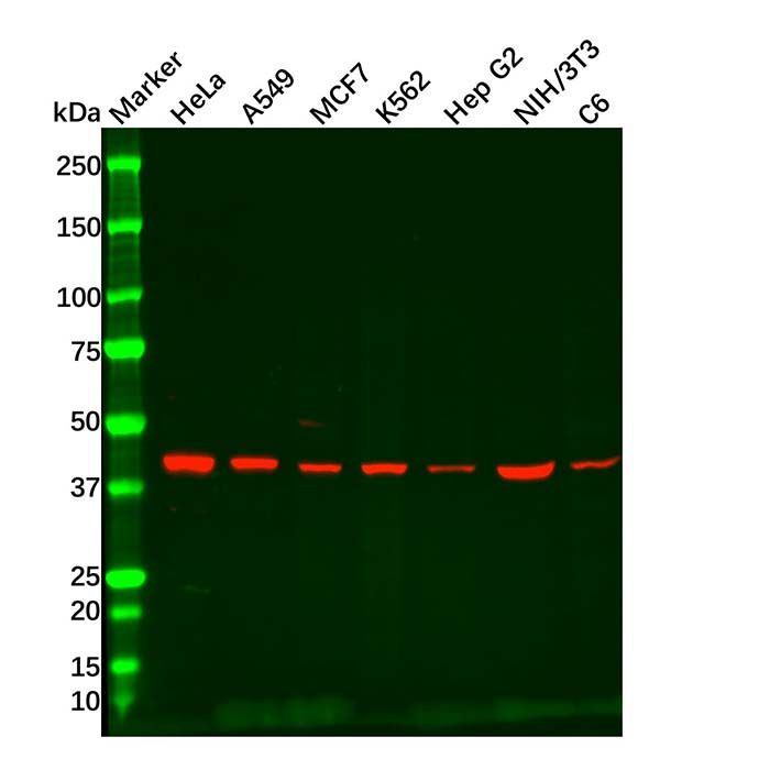 Recombinant ACADM/MCAD Antibody