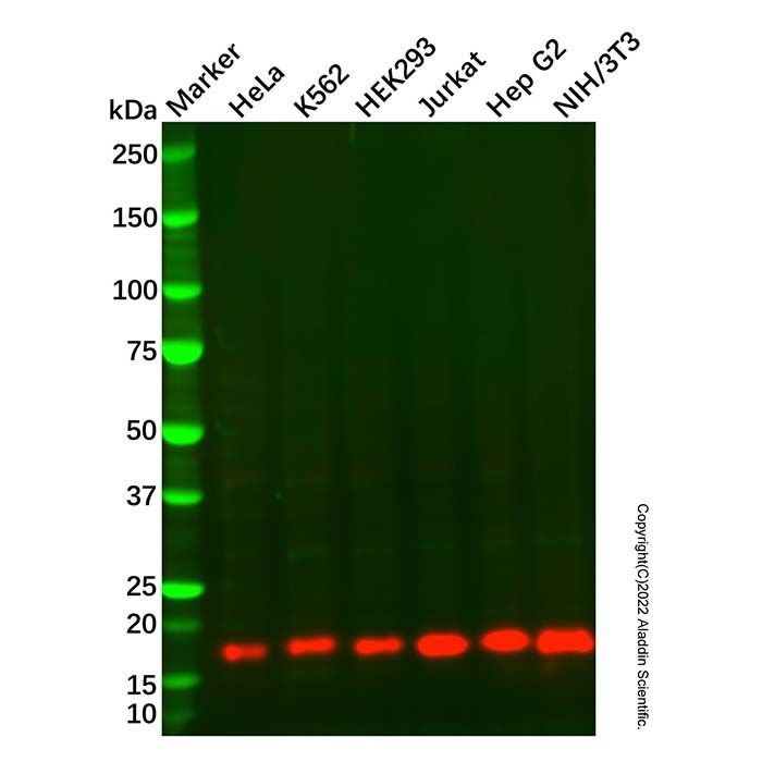Acid phosphatase/ACP1 Mouse mAb