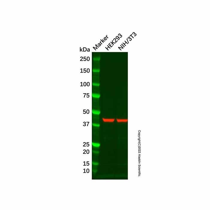 Recombinant ACTC1/ACTA2/ACTG2 Antibody