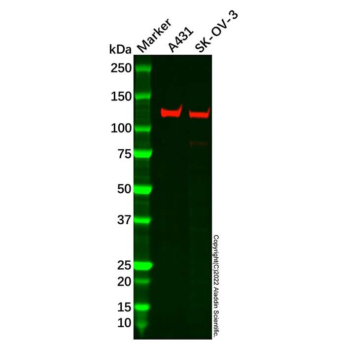 ADAMTS6 Antibody