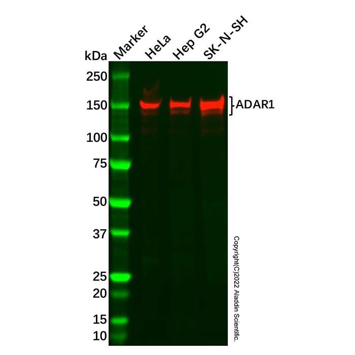 Recombinant ADAR1 Antibody
