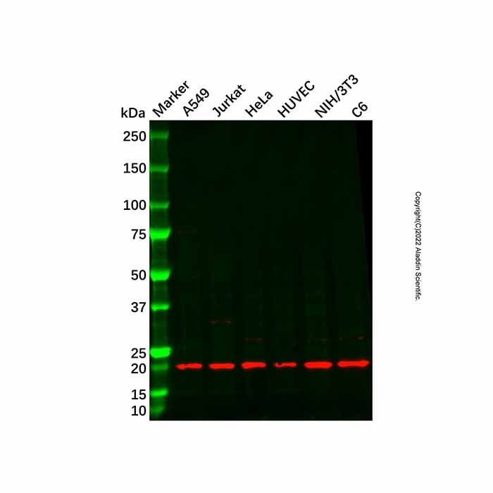 Recombinant AKAP14 Antibody