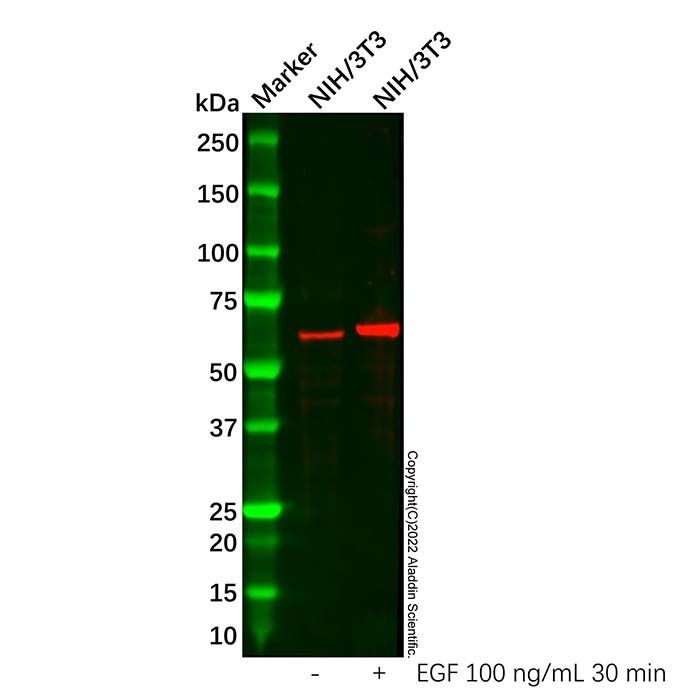 AKT(phospho S473) Antibody