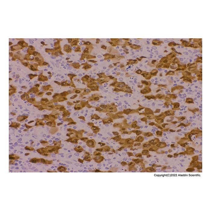 Recombinant ALK Antibody