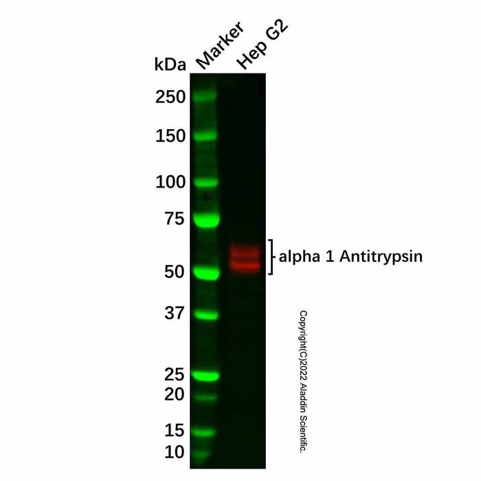 Recombinant alpha 1 Antitrypsin Antibody
