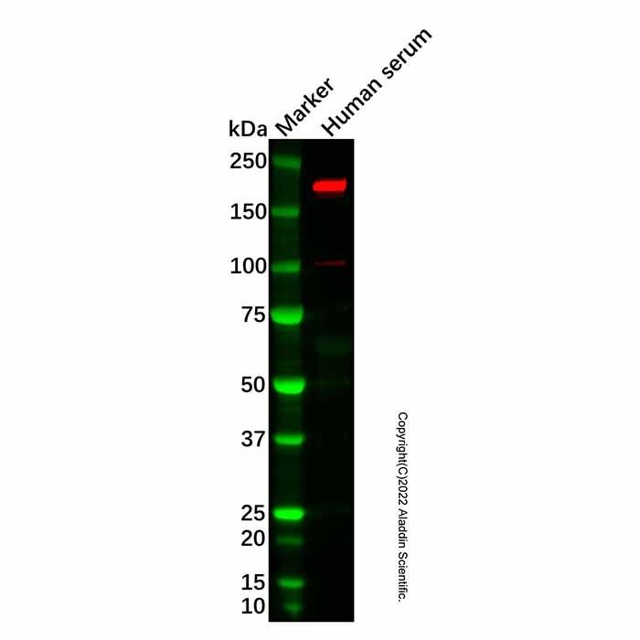Recombinant alpha 2 Macroglobulin Antibody