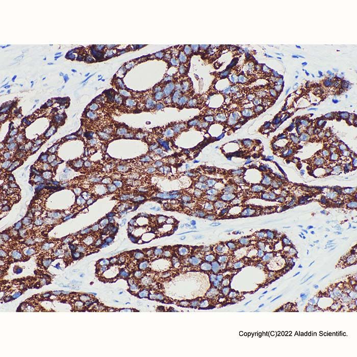 AMACR Mouse mAb