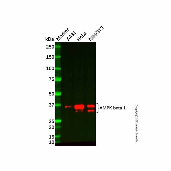 Recombinant AMPK beta 1 Antibody