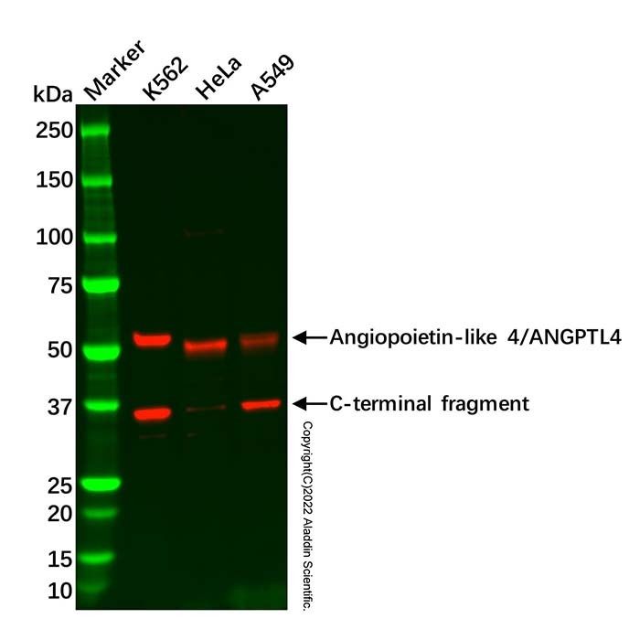 Recombinant Angiopoietin-like 4/ANGPTL4 Antibody