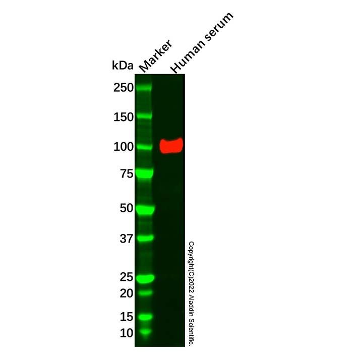 Angiostatin Mouse mAb