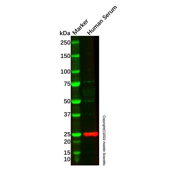 Recombinant Apolipoprotein A I Antibody