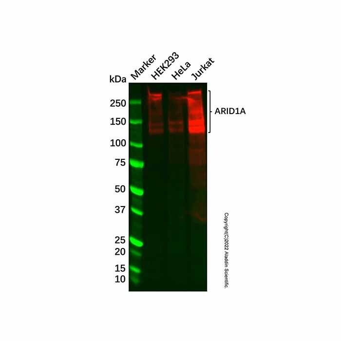 Recombinant ARID1A Antibody