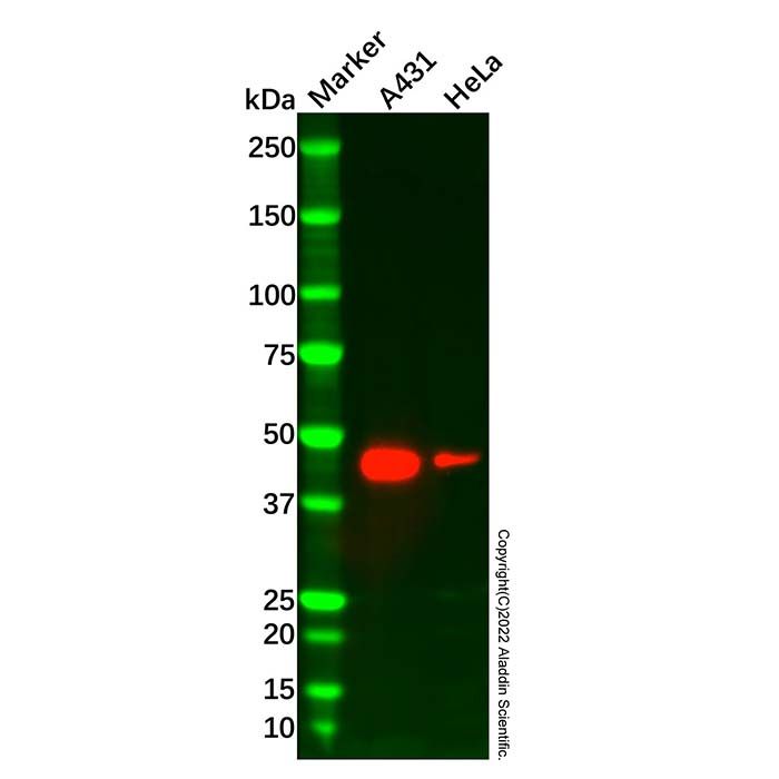 Recombinant ASS1 Antibody