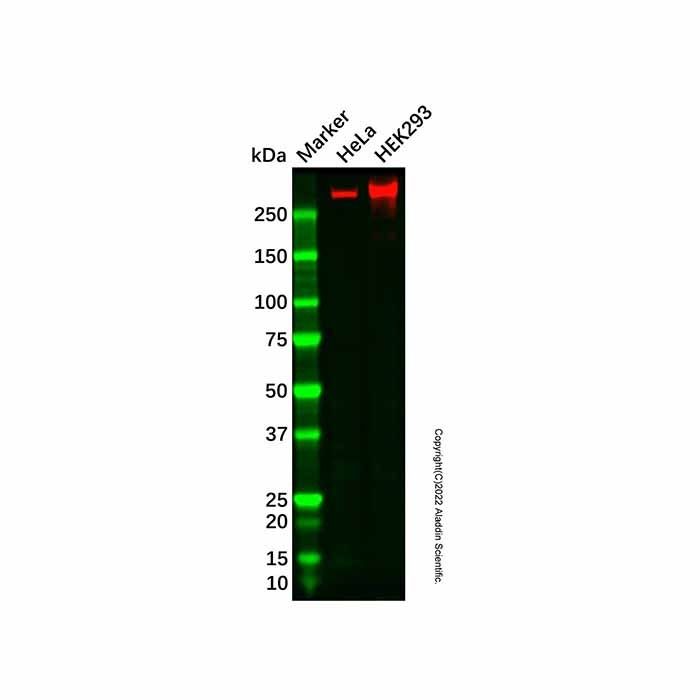 Recombinant ATM Antibody