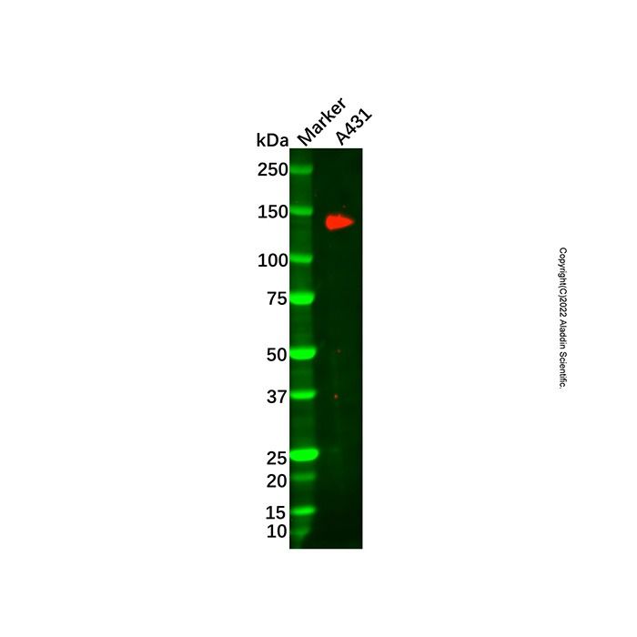 ATP13A2 Antibody