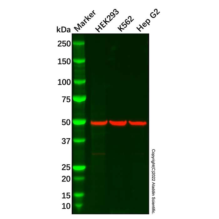 ATP6V1B1 Antibody