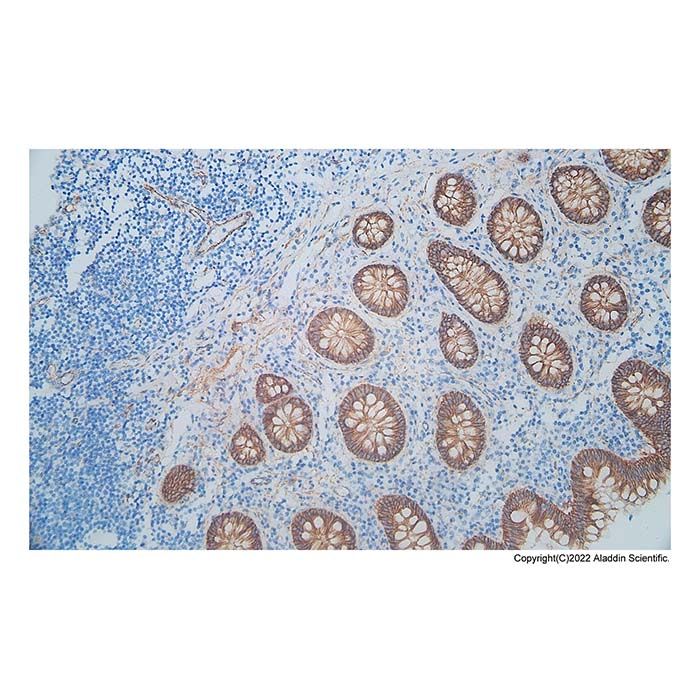 Recombinant beta Catenin Antibody