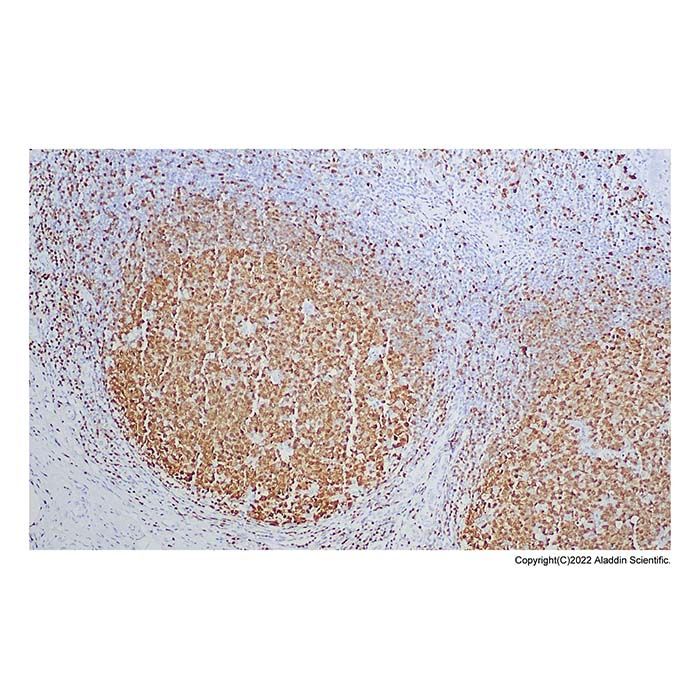 Recombinant BOB1 Antibody