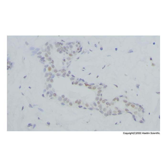Recombinant BRCA1 Antibody