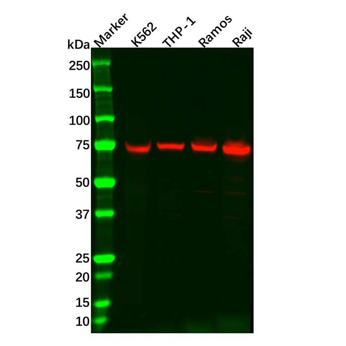 Recombinant BTK Antibody