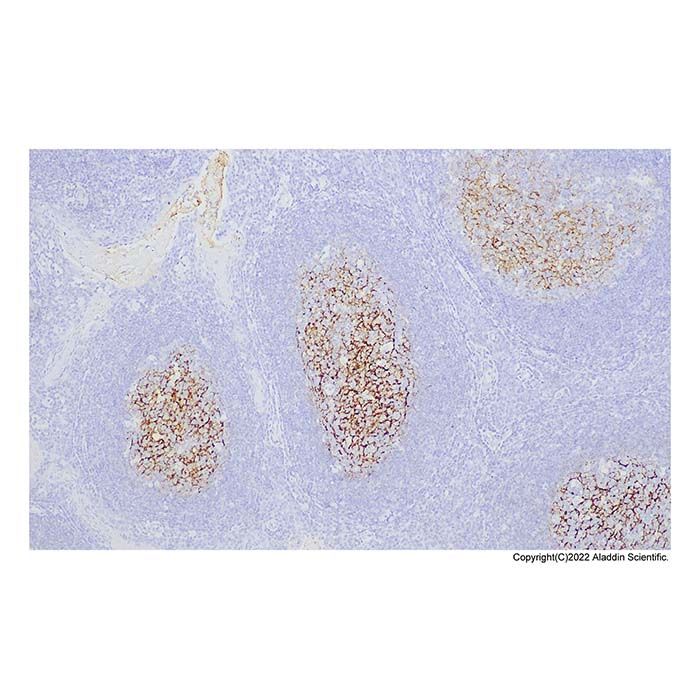 Recombinant C4d Antibody