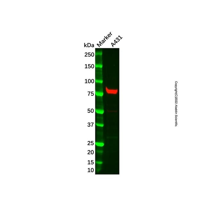 Recombinant Calpain 1 Antibody