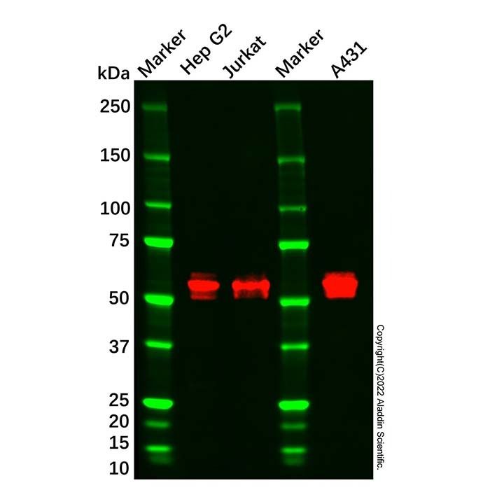CaMKII Mouse mAb