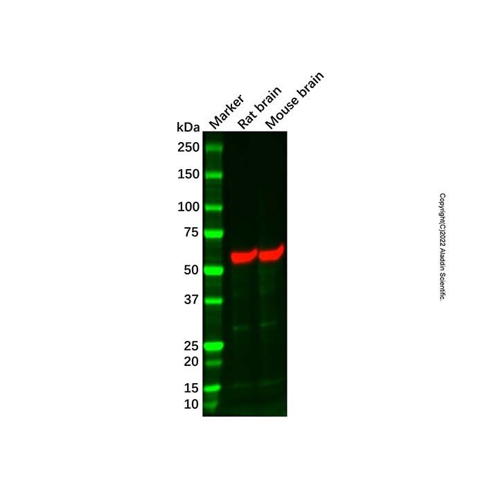 CAMK2B Mouse mAb