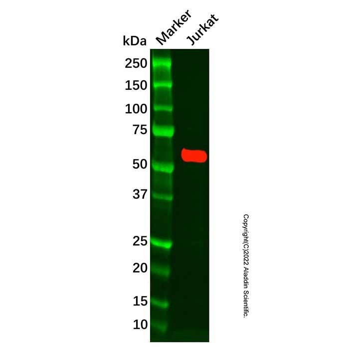 Recombinant CAMKIV Antibody