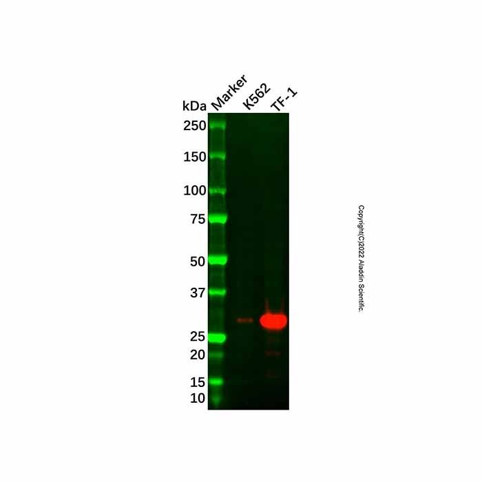 Recombinant Carbonic Anhydrase 1/CA1 Antibody