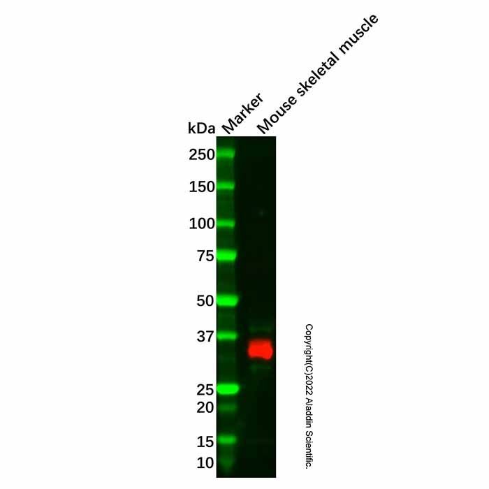 Recombinant Cardiac Troponin T Antibody