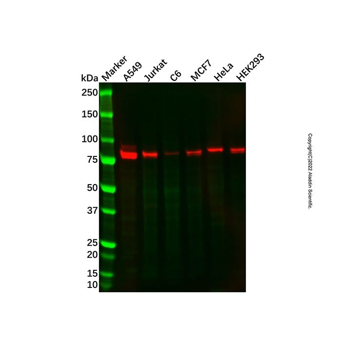 Recombinant CARS Antibody