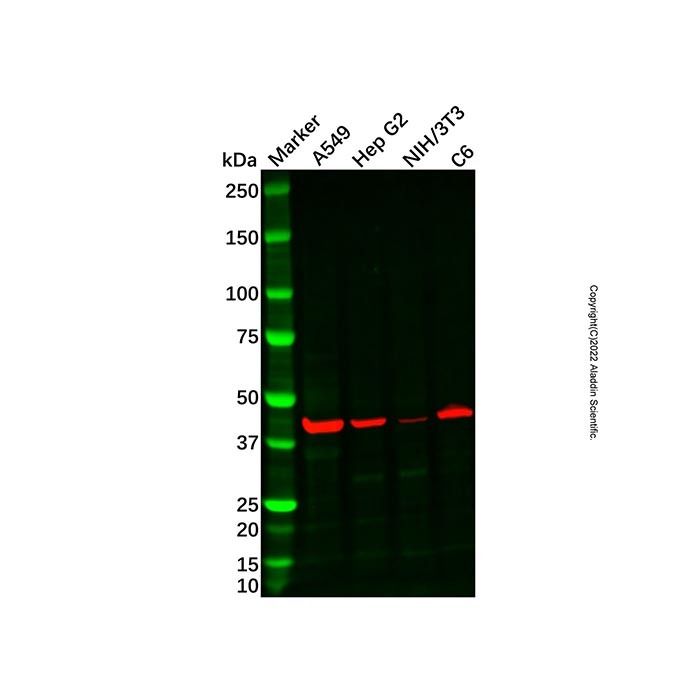 Recombinant Cathepsin L/V/K/H Antibody