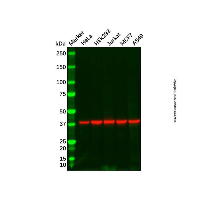 Cathepsin V Antibody