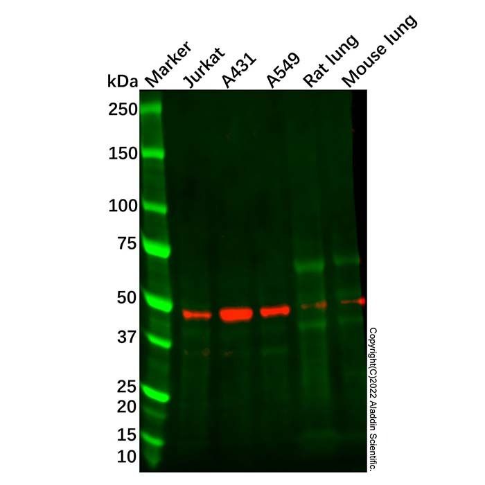 Recombinant CCR8 Antibody