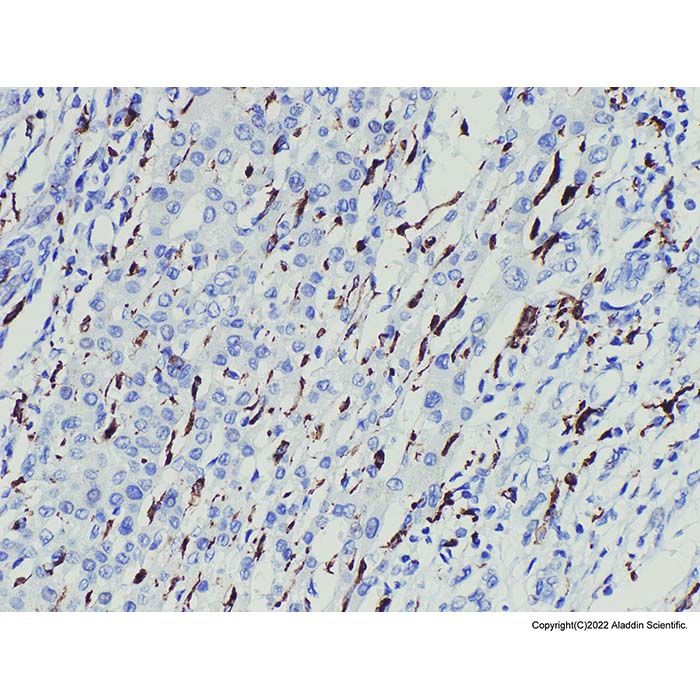 CD163 Mouse mAb