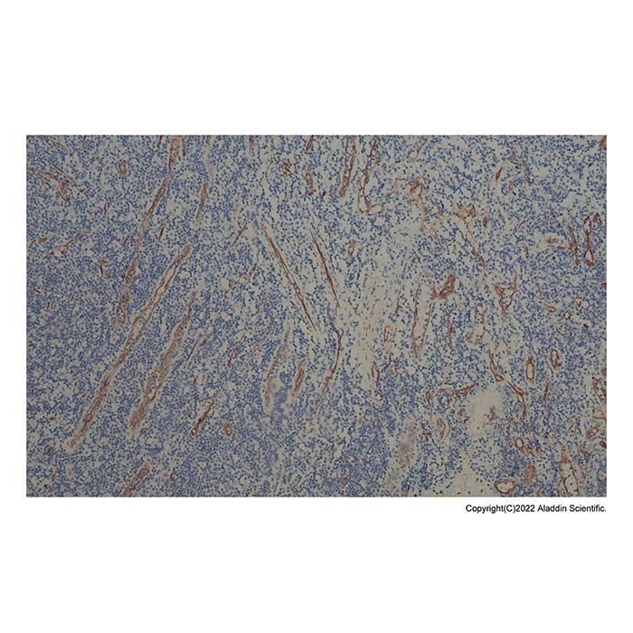 Recombinant CD34 Antibody