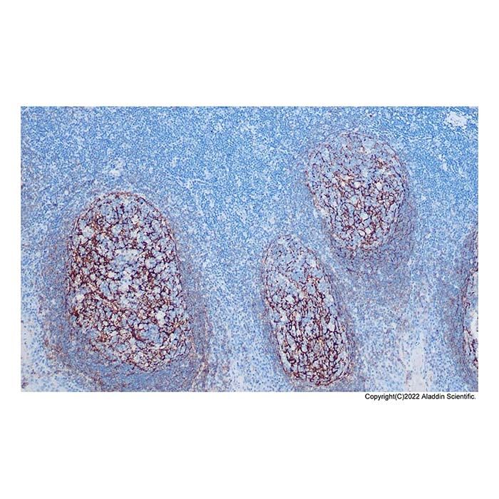 Recombinant CD35 Antibody