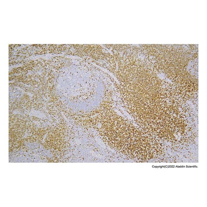 Recombinant CD5 Antibody