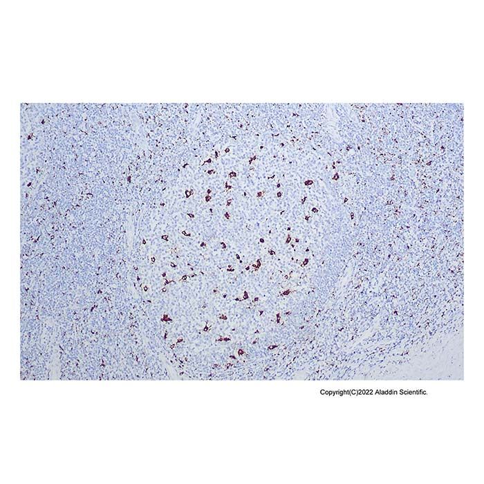 Recombinant CD68 Antibody