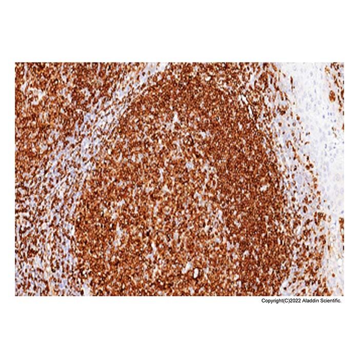 Recombinant CD74 Antibody