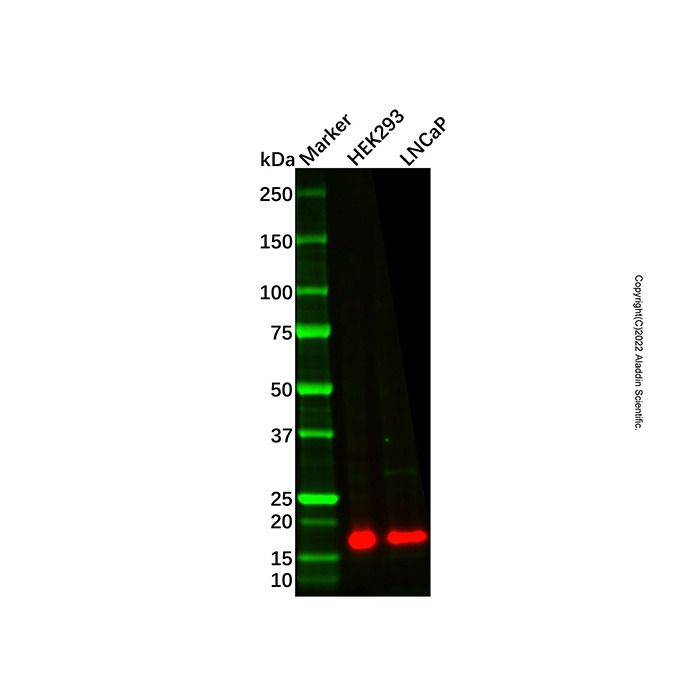 Recombinant CDKN2A/p14ARF Antibody