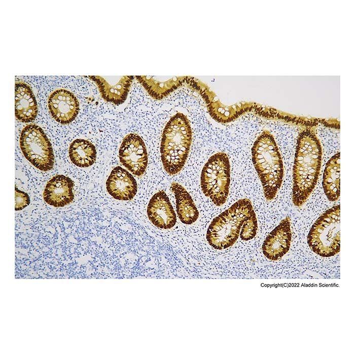 Recombinant CDX2 Antibody
